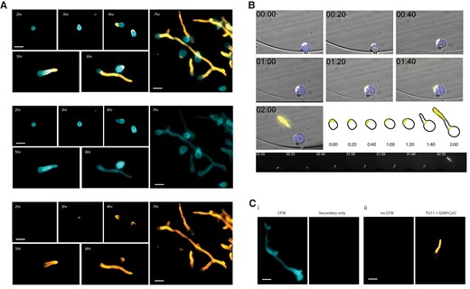 Rhizopus arrhizus var delemar cells immunostained with mAb TG11 at different stages of spore swelling, germination, and hyphal growth. A, Composite photomicrographs (top) and individual channels (middle, bottom) of R arrhizus strain 99-880 with DAPI filters for CFW and Cy5 filters for TG11 + GAM-Cy5. Cells are stained with TG11 + GAM-Cy5 (bottom panel) and CFW (middle panel). Representative cells from liquid culture after 2, 3, 4, 5, 6, and 7 hours of incubation were imaged to visualize binding by mAb TG11 at different stages of cell growth. B, Time-lapse image series of a single live R arrhizus cell grown in media containing CFW and directly conjugated TG11-Cy5 and collected every 20 minutes. Note that indicated times are from the start of imaging with spores pregerminated for 2.5 hours. TG11 is seen to stain the growing hypha, highlighted in the adjacent schematic and Cy5 channel panels below. C, Representative negative controls: i, CFW, secondary only; ii, no CFW, TG11 + GAM-Cy5. Scale bars: 20 μm. CFW, calcofluor white; GAM-Cy5, Cy5-conjugated goat anti-mouse polyclonal IgG; mAb, monoclonal antibody.