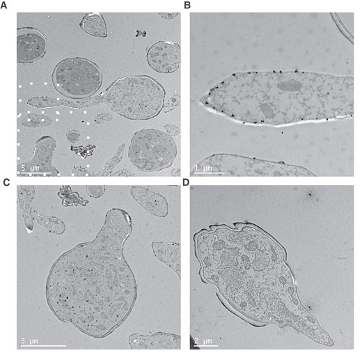 Transmission electron microscopy of immunogold-labeled Rhizopus arrhizus var delemar. Images of R arrhizus var delemar stained with (A–C) TG11 or (D) an IgG2b isotype control and a gold-conjugated secondary antibody. Gold particles are predominantly localized to (B) the hyphal cell wall as well as (C) the cytoplasm of germinating spores. B and C, Higher magnifications of the region identified in panel A by white squares. Note that panel C represents an independent slice of cells imaged in panel A.