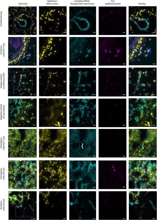 Ex vivo murine lung tissue infected with Rhizopus arrhizus var delemar and immunostained with mAb TG11. Photomicrographs of murine lung tissue uninfected (first row only) or infected with R arrhizus strain 99-880 or Aspergillus fumigatus strain A1160p+. Images were acquired with FITC (SYBR Green, column 2), DAPI (CFW, column 3), and Cy5 (mAb TG11-GAM; mAb JF5-GAM, column 4) fluorescence filters. Tissue slices are stained as follows: first, second, and fifth rows—mAb TG11 plus GAM-Cy5 (magenta); sixth and seventh rows—mAb JF5 plus GAM-Cy5 (magenta); third row—IgG2b isotype control plus GAM; fourth row—no primary plus GAM alone, CFW for fungal chitin (blue), and SYBR Green for DNA to reveal host cell nuclei (yellow). Note that lung connective tissue and alveolae also stain with CFW but not with mAb TG11-GAM or mAb JF5-GAM. Isotype control is a representative image for both conjugated antibodies. Images acquired in Z-stacks every 0.2 µm are presented as summed Z-projections. Scale bars: 10 μm. CFW, calcofluor white; GAM-Cy5, Cy5-conjugated goat anti-mouse polyclonal IgG; mAb, monoclonal antibody.