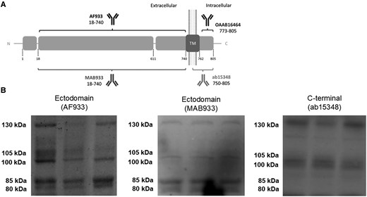 Several ACE2 full-length and fragment species coexist in CSF and result altered in patients with encephalitis with and without SARS-CoV-2 infection. A, Schematic representation of ACE2 as a transmembrane type I protein, and of the epitopes recognized by antibodies used in this study (not drawn to scale). ACE2 anti-ectodomain antibodies were AF933 (R&D Systems; goat polyclonal; immunogen, amino acid residues 18–740; 1:200 dilution) and MAB933 (R&D Systems; mouse monoclonal; immunogen, amino acid residues 18–740; 1:500 dilution); anti-C-terminus was antibody ab15348 (Abcam; rabbit polyclonal; immunogen, synthetic peptide corresponding to human ACE2 amino acid residues 788–805; 1:500 dilution). The signal peptide (aa 1–17), carboxypeptidase (aa 18-611), and transmembrane (aa 740–762) domains are represented. The sites of ACE2 shedding with ADAM17 are also indicated (between aa 652–659 and 697–416). The resulting ectodomain fragments are recognized by the AF933 and MAB933 antibodies, but not by the C-terminal antibody ab15348. B, Representative blots of ACE2 immunoreactive species in CSF from nondisease controls using different antibodies, as indicated. Abbreviations: aa, amino acid; ACE2, angiotensin-converting enzyme 2; CSF, cerebrospinal fluid; SARS-CoV-2, severe acute respiratory syndrome coronavirus 2; TM, transmembrane.