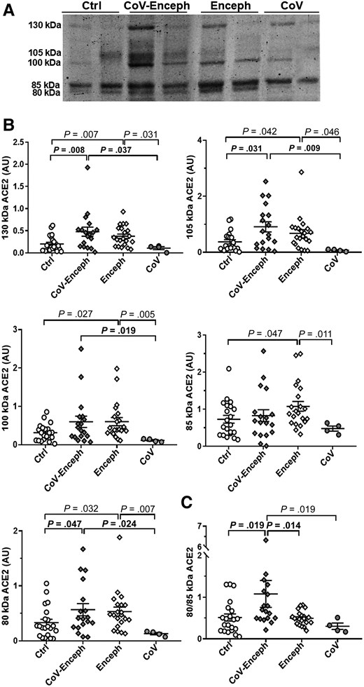 Altered balance of ACE2 fragments is a feature of patients with encephalitis and SARS-CoV-2 infection. A, Levels of CSF ACE2 species were determined in neurologically healthy controls (Ctrl), patients with SARS-CoV-2 infection with encephalitis (CoV-Enceph), patients with encephalitis without SARS-CoV-2 infection (Enceph), and patients with SARS-CoV-2 infection without neurological symptoms (CoV). Samples were blotted with the AF933 antibody against the ectodomain of ACE2. B, Immunoreactivity levels were determined for the 85- and 80-kDa fragments and for the 130-, 105-, and 100-kDa full-length species. C, The relationship between ACE2 fragments, for each sample, are represented by the graph of the quotient obtained by dividing the level of immunoreactivity of the 80 kDa band by the level of immunoreactivity of the 85 kDa band (80/85 kDa). Values are presented as mean ± SEM; P values are indicated; significant changes compared with CoV-Enceph group are highlighted in bold. Abbreviations: ACE2, angiotensin-converting enzyme 2; AU, arbitrary unit; CSF, cerebrospinal fluid; SARS-CoV-2, severe acute respiratory syndrome coronavirus 2.