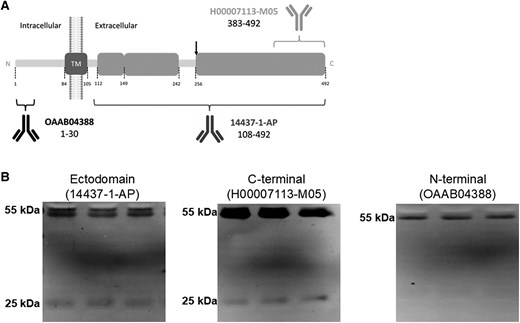 TMPRSS2 full-length and active fragments coexist in CSF and their relative abundances are altered in patients with encephalitis. A, Schematic representation of TMPRSS2 as a transmembrane type II protein and of the epitopes recognized by the antibodies used in this study (not drawn to scale). TMPRSS2 was resolved with the ectodomain antibody 14437-1-AP (Proteintech; rabbit polyclonal; immunogen, a recombinant protein containing aa 108–492; 1:1000 dilution), the anti-C-terminus antibody H00007113-M05 (Abnova; mouse monoclonal; immunogen, a recombinant protein containing aa 383–492; 1:500 dilution), or the anti-N-terminus antibody OAAB04388 (Aviva Systems Biology; rabbit polyclonal; immunogen, synthetic peptide between aa 1 and 30; 1:1000 dilution). The site of autoproteolytic cleavage at the ectodomain to acquire proteolytic activity is indicated (aa 255–256). The resulting ectodomain fragment is recognized by the 14437-1-AP and C-terminal antibodies, but not by the N-terminal antibody OAAB04388. The transmembrane (aa 84–105) domain is also indicated. B, Representative blots of TMPRSS2 immunoreactive bands present in nondisease CSF samples using different antibodies, as indicated. Abbreviations: aa, amino acid; CSF, cerebrospinal fluid; SARS-CoV-2, severe acute respiratory syndrome coronavirus 2; TM, transmembrane; TMPRSS2, transmembrane protease serine 2.