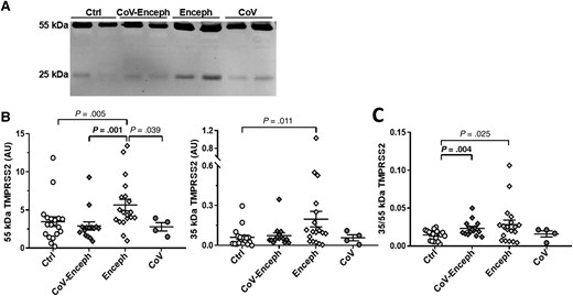 Altered balance of TMPRSS2 active fragment in patients with encephalitis. A, CSF samples from neurologically healthy controls (Ctrl), patients with SARS-CoV-2 infection with encephalitis (CoV-Enceph), patients with encephalitis without SARS-CoV-2 infection (Enceph), and patients with SARS-CoV-2 infection without neurological affectation (CoV) were probed with the 14437-1-AP antibody against the ectodomain of TMPRSS2. B, Immunoreactivity levels were determined for the 25-kDa fragment and for the 55-kDa full-length species. C, The relationship between the fragment and full-length species, for each sample, are represented by the graph of the quotient obtained from the 25-kDa compared to the levels of the 55-kDa TMPRSS2 species (25/55 kDa). Values are presented as mean ± SEM; P values are indicated; significant changes compared with CoV-Enceph group are highlighted in bold. Abbreviations: ACE2, angiotensin-converting enzyme 2; AU, arbitrary unit; CSF, cerebrospinal fluid; SARS-CoV-2, severe acute respiratory syndrome coronavirus 2; TMPRSS2, transmembrane protease serine 2.