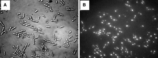 Light (a) and epifluorescent micrograph (b) of Bacillus thuringiensis var. israelensis cells at 14 h of fermentation (S 0 = 30.8 g/l), showing the intracellular granules of PHB stained with Nile blue. The Nile blue A-stained cells were photographed with simultaneous fluorescent and visible light