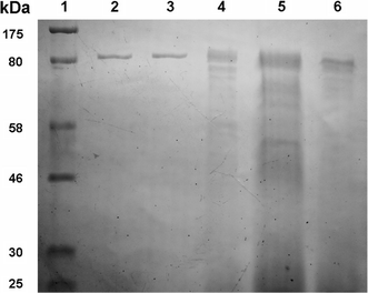 SDS-PAGE profile of IAM purification. Lane 1 molecular mass standard (size as indicated); Lanes 2, 3 active fraction by Mono Q ion exchange chromatography; Lane 4 active fraction by Sephacryl S-100 gel filtration chromatography; Lane 5 active fraction by ammonium sulfate precipitation; Lane 6 active fraction by DEAE ion exchange chromatography