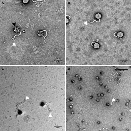 Transmission electron microscope micrographs of bacteriophage DTL isolated from lysed fermentation cultures. The solid black arrow identifies the capsid head, the white arrow/black border identifies the phage tail, and the white arrow identifies the rosette-style tail fibers. a 96-nm scale bar (KPTA stain), b 96-nm scale bar (KPTA stain), c 100-nm scale bar (UAc stain), d 0.46-µm scale bar (UAc stain)