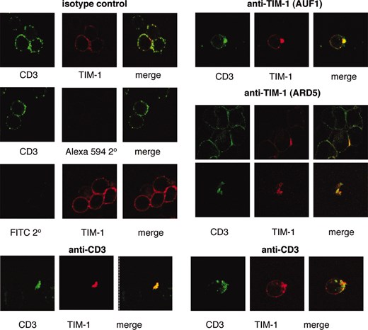 Confocal microscopy reveals colocalization of CD3 and TIM-1 upon cell activation with anti-CD3, or by cross-linking of TIM-1 with mAb ARD5. The isotype control panel (left) shows cells stained for CD3 or for TIM-1 after incubation with isotype control mAbs. Detection of CD3 with anti-mouse FITC also included the secondary only control for TIM-1 detection (streptavidin Alexa 594) and visa versa, as indicated. The anti-TIM-1 panel shows cells stained for CD3 or for TIM-1 after incubation with the indicated cross-linking anti-TIM-1 mAbs. The anti-CD3 panel (lower) shows cells stained for CD3 or for TIM-1 after incubation with cross-linking anti-CD3 mAb. The data shown are derived from two of three experiments and the results are representative.