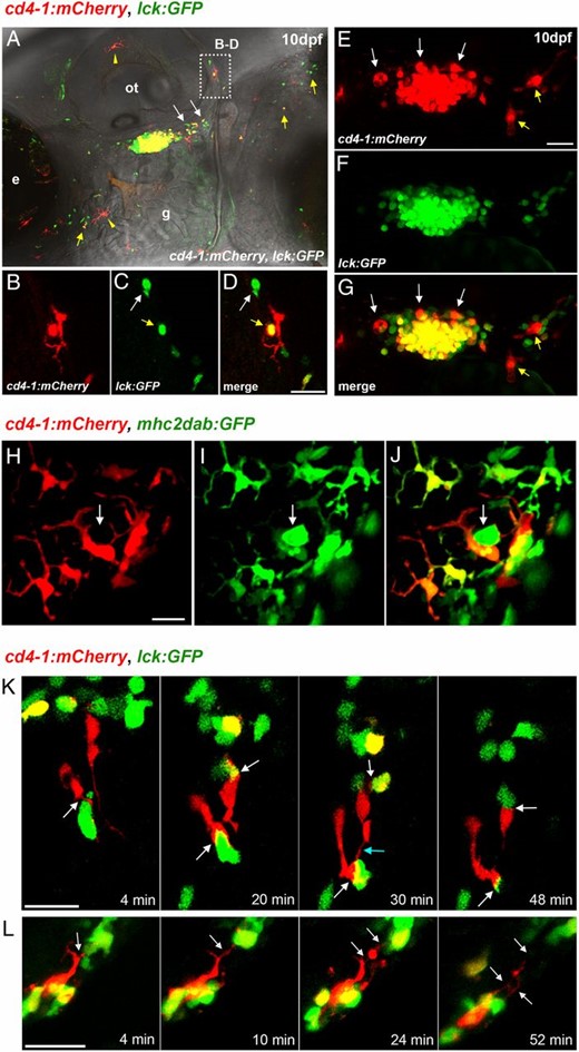 Developmental expression of Tg(cd4-1:mCherry). (A) Composite image of Tg(cd4-1:mCherry) and lck:GFP expression at 10 dpf. T cells can be seen migrating out of the thymus (white arrows). CD4-1+ and CD4-1− T cells are visible in the integument (yellow arrows), as is a population of skin-resident MNPs (yellow arrowheads). (B–D) High magnification image from the otic region in (A) showing a CD4-1− T cell (white arrow) and a CD4-1+ T cell (yellow arrow) in close contact with an MNP (large red cell). (E–G) Intrathymic MNPs (white arrows) and perithymic MNPs (yellow arrows) can be identified by 10 dpf. (H–J) Images of Tg(cd4-1:mCherry);mhc2dab:GFP MNPs located in the skin of 10 dpf zebrafish. (H–J) The Tg(cd4:mCherry)+ MNPs exhibit a noticeably more dendriform morphology than do the mhc2dab:GFP+ single-positive cells (I and J, white arrows). (K and L) Live time-lapse imaging of the perithymic region at 10–14 dpf. (K) Extended synapsing between CD4-1+ MNPs and T cells (white arrows). MNPs are also seen to connect temporarily (blue arrow). (L) Cytoplasmic tethering (white arrows) occurs between an MNP and T cell. Scale bars, 20 μm. Denoted features are eye (e), otic vesicle (ot), gill (g).