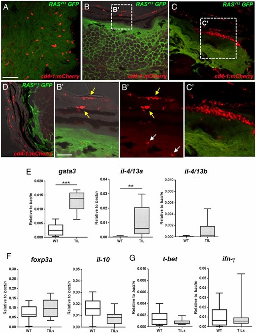 Differentiation of tumor infiltrating CD4-1+ T cells. (A–D) Cryosection and immunostain of zebrafish tumors from animals carrying the Tg(cd4-1:mCherry) and mitfa:RASV12 (GFP labeled) transgenes. (A) Densely infiltrated tumor showing CD4-1+ cells (red) and tumor cells (green) (Scale bar, 50 μm). (B and B′) Tumor with few infiltrating CD4-1+ cells shown (white arrows in B′). CD4-1+ MNPs can be seen in the overlying epidermis (yellow arrows in B’). (C and C′) Clustering of immune cells in adjacent skin. (D) A melanoma lesion with no detectable CD4-1+ infiltrate. (E–G) qPCR analysis showing gene expression in CD4-1+ TIL T cells compared with wild-type (WT) T cells from the kidney and spleen. (E) CD4-1+ TILs significantly upregulate the expression of gata3 and il-4/13a, but not il-4/13b. (F and G) The expression of foxp3a, il-10 (F), and t-bet or ifn-g (G) is not significantly altered in CD4-1+ TILs. Error bars represent SD; n = 9–11, p < 0.05. **p < 0.01, ***p < 0.001.