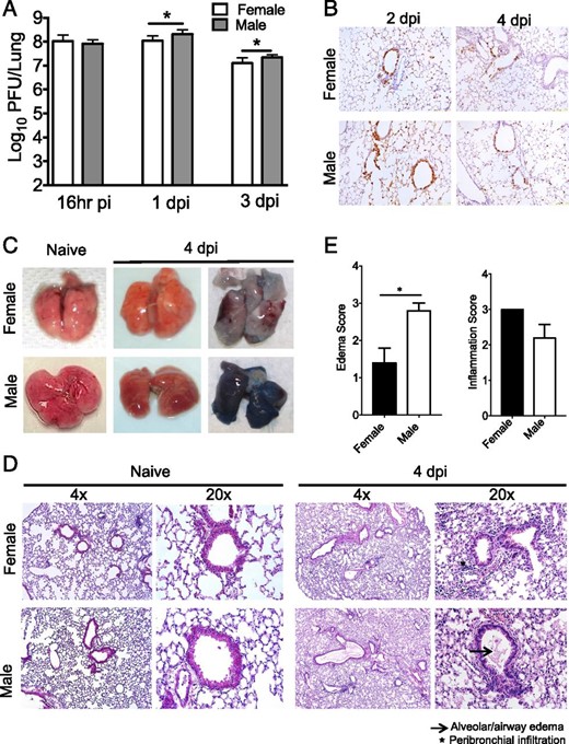 Virus titers and lung pathology in MA15-infected mice. Nine-month-old male and female mice were infected with 5000 PFU MA15, and lungs were analyzed for titer (A), viral Ag staining in the lungs at different times p.i. (original magnification ×10) (B), gross pathology and vascular leakage in lungs of naive and MA15-infected male and female mice on day 4 p.i. (C), and histology in naive and MA15-infected male and female mice on day 4 p.i. (D). (E) Lung inflammation and edema scores were determined at day 4 p.i. These data are derived from four or five mice per group. (A) Data are representative of two independent experiments. Statistical significance was determined as described in Materials and Methods. *p < 0.05.