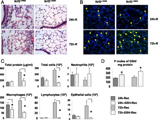 Effects of exogenous GSH on hyperoxia-induced lung inflammation and injury: Nrf2−/− mice immediately after 48-h hyperoxia were given GSH ester (5 mmol/kg body weight) or vehicle PBS at every 24 h for 3 days and lungs were harvested. Lungs sections and BAL analyses were done as described above. A, Histology of lungs isolated from mice supplemented with PBS or GSH ester at 24 and 72 h (top panel) in recovery. B, Lung sections were immunostained using anti-SPC Abs to visualize the presence of type II epithelial cells. The positively stained cells are indicated with arrows. Images shown are representative of lung section from three different mice in each group. C, Graphs represent the total protein, total cells, neutrophils, macrophages, lymphocytes and epithelial cells in the BAL fluid. D, Graph represents the GSH levels in the lungs of Nrf2−/− mice at 24- and 72-h recovery following GSH supplementation. *, p < 0.001 versus Nrf2−/− GSH-supplemented mice (n = 3).