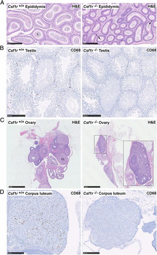 Histology of reproductive organs. Formalin-fixed and paraffin-embedded epididymides, testes, and ovaries were stained with H&E or an Ab against CD68. (A) Longitudinal sections of epididymides and (B) testes. Images are representative of six rats aged between 7 and 11 wk. Arrows point to atypical residual bodies. Scale bar, 250 μm. (C and D) Longitudinal sections of ovaries stained with H&E and CD68. Images are representative of seven rats aged 11–12 wk. Scale bar, 1.5 mm (C) and 250 μm (D). In wild type and Csf1r+/− rats, an average of 5.8 (range 3–11) corpora lutea were observed per ovary in H&E-stained sections (n = 10) compared with only 0.7 (range 0–3) in Csf1r−/− rats (n = 7). Whole slide images were produced with a NanoZoomer slide scanner and images were exported with NDP.view2 software (Hamamatsu Photonics). CL, corpus luteum, S, sperm.