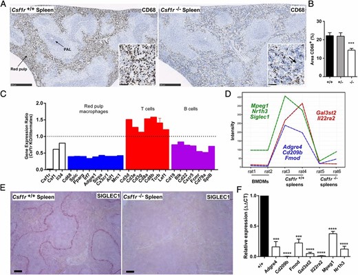 Analysis of spleens in Csf1r−/− rats. (A) Formalin-fixed and paraffin-embedded spleens were stained with an Ab against CD68. Scale bar, 500 μm. Inset shows an area of red pulp. Scale bar, 50 μm. Arrow points to infiltration of lymphocytes in Csf1r−/− inset. Whole slide images were produced with a NanoZoomer slide scanner and jpeg files exported with NDP.view2 software. PAL, periarteriolar lymphoid sheath. (B) The area of CD68+ cells in the red pulp was determined from 10 images per spleen (at original magnification ×80) using ImageJ (Fiji) (n = 10+/+, 8+/−, and 13−/−). Graph shows mean + SEM. Significance compared with wild type is indicated by ***p = 0.0002 using a t test. (C) Microarray data from spleens were used to determine expression ratios for genes associated with red pulp macrophages and T and B cells. Graph shows mean + SEM for genes with multiple probes. (D) Gene expression plot generated in Graphia Pro highlighting splenic macrophage-specific genes which were downregulated in Csf1r−/− rats. (E) Formalin-fixed and paraffin-embedded adult spleens were stained with an Ab against SIGLEC1. Scale bar, 100 μm. Images are representative of 2+/+ and 3−/− rats and two repeat experiments. (F) Total RNA was isolated from spleens of adult wild type (+/+) and Csf1r−/− rats (n = 3) for analysis of candidate marginal zone macrophage-associated gene expression identified in (D) via quantitative PCR. Graph shows mean + SEM. Significance compared with wild type is indicated by ***p = 0.003 and ****p < 0.0001 using a t test.