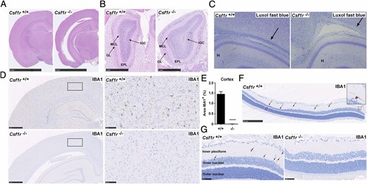 Analysis of brains from Csf1r−/− rats. All brains were formalin fixed and paraffin embedded for histology and immunohistochemistry. (A) Brains from 11-wk-old rats were stained with H&E. Images are representative of seven rats per genotype. Scale bar, 5 mm. (B) Adult heads were fixed in formalin and stained with H&E following EDTA decalcification. Image shows olfactory bulbs in situ. Scale bar, 1 mm. Image representative of seven rats per genotype. EPL, external plexiform layer; GL, glomerular layer; IGC, internal granular cell layer of the olfactory bulbs; MCL, mitral cell layer. (C) Formalin-fixed brains from 3-wk-old rats were stained with Luxol fast blue. Arrows point to myelin preservation and myelin pallor in wild type and mutant rats, respectively. Image of three rats per genotype. (D) Adult brains (8–14 wk) were stained with an Ab against IBA1. Scale bar, 1 mm (left) or 100 μm (right). (E) For each rat, 10 20× images of the cortex were analyzed for the percentage of IBA1+ staining using ImageJ (n = 7 per genotype). Graphs show mean + SEM. Significance compared with wild type is indicated by ****p < 0.0001 using a t test. (F and G) Formalin-fixed eyes were stained with an Ab against IBA1. Arrows point to IBA1+ microglia in the inner plexiform layer of the retina. Images are representative of two rats per genotype, two repeat experiments. Scale bar, 250 μm (F) and 50 μm (G).