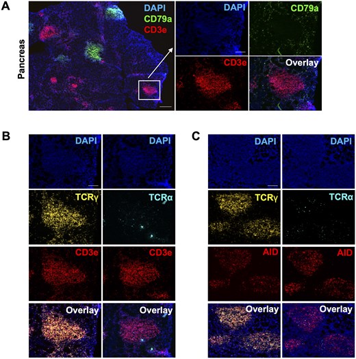 Nurse shark pancreas houses γδ-enriched T cell clusters that are also positive for AID and Ki67 transcripts. (A) Representative RNAscope in situ hybridization images of nurse shark pancreas show CD3e transcript positive T cell clusters that are spatially distant from the CD79a+ B cell follicles. (B) Representative RNAscope in situ hybridization images of nurse shark pancreas tissue sections show T cell clusters are enriched in γδ T cells. (C) Representative RNAscope in situ hybridization images of nurse shark pancreas show AID transcript expression localized within T cell clusters. (A–C) Images are representative of 2 nurse sharks that were euthanized 50-d post-prime with PE, providing two biological replicates (n = 2). Scale bars = 100 µm.