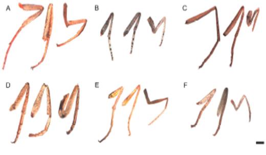 Photographs of limbs (from left: T3, T2, T1) from representative male individuals of (a) Epargyreus clarus (Hesperiidae), (b) Satyrium titus (Lycaenidae), (c) Junonia coenia (Nymphalidae), (d) Parnassius phoebus (Papilionidae), (e) Zerene eurydice (Pieridae), and (f) Apodemia mormo (Riodinidae). Scale bars = 1 mm. Note marked reduction of T1 limbs in (c) and (f). High quality figures are available online.