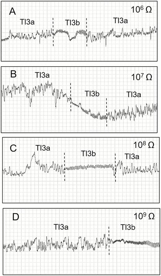 Waveforms recorded using EPG from Tibraca limbativentris on rice stalk at 106 Ohms (A), 107 Ohms (B), 108 Ohms (C), 109 Ohms (D), and 50 mV AC applied signal. Expanded view of waveforms Tl3a and Tl3b occurring interspersed with each other. Coarse structure of waveforms observed with Windaq compression: 4 (0.8 s/vertical div) and gain: 32× (A, B); 16× (C and D).