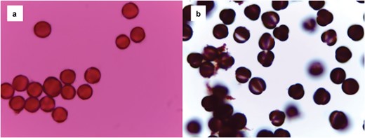 a) A microscope slide of pollen grains before acetolysis using a large amount of pollen collected from honeybee hives for practice, b) and a slide of pollen grains following acetolysis using pollen from the same practice source. The polarity of the pollen grains and the apertures are more easily viewed in the second photo (photograph credit: Kirsten Warcup).