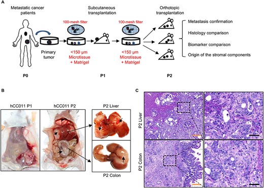 Establishment of a metastatic CRC PDX mouse model. (A) Flow chart of the development of metastatic CRC PDX mouse model. The differences compared with previous methods were labelled in red colour. (B) Representative PDX images from heterotopic and orthotopic xenograft models of hCC011. (C) Representative H&E data for metastasis confirmation of the orthotopic models. CRC, colorectal cancer; PDX, Patient-derived xenograft model; H&E, haematoxylin and eosin. Scale bars, 50 μm in black, 200 μm in yellow.