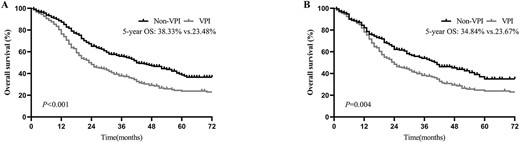 Overall survival (OS) of patients with and without visceral pleural invasion (VPI), (A) before and (B) after propensity score matching (PSM).