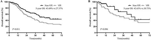 OS of patients with and without VPI in ≤3 cm (A) and >3 cm (B) tumours in pN0 disease after PSM.