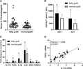 IL-17a was up-regulated after human orthotopic liver transplantation with fatty graft. (A) The serum IL-17a levels in LT recipients were detected at 2 h after LT by ELISA. (B) The serum AST/ALT levels at 2 h after LT were compared between LT recipients with fatty grafts and normal grafts. (C) The mRNA levels of intragraft IL-17a, TLR4, IL-1β, IL-6, CXCL1, and CXCL2 at 2 h after LT were examined by RT-PCR. The data were present as the fold changes to normal liver from healthy donors. (D) The correlation between intragraft IL-17a mRNA and CXCL1 mRNA expression in fatty grafts was analyzed using Person Correlation Coefficient. *P < 0.05 between groups of fatty graft and normal graft