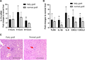 IL-17a was up-regulated after rat orthotopic liver transplantation with fatty graft and promotes graft inflammation. (A) The intragraft IL-17a mRNA expressions were detected by RT-PCR at 2, 6, and 24 h after rat LT. (B) The intragraft expressions of TLR4, IL-1β, IL-6, CXCL1, and CXCL2 at 6 h after rat LT were detected by RT-PCR. *P < 0.05 between groups of fatty graft and normal graft. (C) Representative H&E stained liver sections from graft tissues of fatty graft and normal graft at 6 h after rat LT. Red arrows pointed to the hepatocellular necrosis areas where were replaced by infiltrated inflammatory cells. Bar = 200 μm