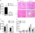 Knockout (KO) of IL-17a attenuated hepatic ischemia–reperfusion (IR) injury in mouse model with fatty liver. (A) The serum IL-17a levels in IL-17 WT mice with fatty liver and normal livers were examined by ELISA at 6 h after hepatic IR injury. (B) Representative H&E stained liver sections from liver tissues of IL-17 WT and KO mice with fatty liver and normal liver at 6 h after hepatic IR injury. Red arrows pointed to the hepatocellular necrosis areas. Bar = 200 μm. (C) To compare the liver function between IL-17a KO and WT mice in response to IR injury, serum ALT level at 6 h after hepatic IR injury was detected using the mouse ALT kit. (D) Hepatic TLR4, IL-1β, IL-6, CXCL1, and CXCL2 mRNA expressions at 6 h after IR injury in IL-17 KO and WT mice with fatty liver were detected by RT-PCR. (E) The neutrophils were stained by anti-mouse Ly-6G antibody in the groups of IL-17a KO and WT mice with or without fatty liver after hepatic IR injury. Bar = 100 μm. The bar chart represented the numbers of positive Ly-6G cells per field in each group. #P < 0.05 between groups of fatty liver and normal liver. *P < 0.05 between groups of IL-17a KO and WT mice
