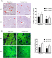 IL-17a knockout suppressed activation of mitochondria-mediated apoptosis after hepatic IR injury in fatty liver. (A) Representative figures of Tunel staining in the groups of IL-17a KO and WT mice with or without fatty liver after hepatic IR injury. Bar = 400 μm. The bar chart (right) represented the numbers of positive Tunel cells per field in each group. (B) Hepatic mitochondrial outer membrane permeabilization (MOMP) was evaluated using a living intravital image system. Representative figures of MOMP (loss of green) captured in the groups of IL-17a KO and WT mice with or without fatty liver after hepatic IR injury. Bar = 200 μm. The bar chart represented the percentages of MOMP per field in each group. *P < 0.05 between groups of IL-17a KO and WT mice