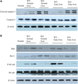 IL-17a activated NF-κB signaling pathway after hepatic IR injury in fatty liver. Western blots were performed on whole liver protein extracts with antibodies specific to cleaved caspase-3, total caspase-3, Bad, Bcl-2, phosphorylated NF-κB, and total NF-κB. β-actin expression was used as the loading control. Representative autoradiographs of (A) cleaved caspase-3, total caspase-3, (B) Bad, Bcl-2, phosphorylated NF-κB, and total NF-κB were shown in each group