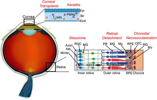 Cell types involved in Fas ligand (FasL)-mediated ocular pathologies. In corneal transplants, FasL expressed on donor corneal endothelium and epithelium promotes graft survival through apoptosis of Fas+ T cells. However, overexpression of membrane-associated FasL (mFasL) on corneal tissue results in accelerated graft rejection mediated by Fas+ neutrophils. In keratitis, FasL expressed on the corneal endothelium and epithelium is thought to limit the infiltration of Fas+ inflammatory cells. However, expression of mFasL-only exacerbates nonspecific tissue damage and corneal scarring through activation of infiltrating Fas+ neutrophils, whereas the soluble FasL fragment (sFasL) inhibits neutrophil-mediated inflammation and prevents nonspecific tissue damage. In Glaucoma, FasL expressed on microglia promotes neuroinflammation through activation of Fas+ astrocytes, Mueller glia, and microglia, as well as apoptosis of Fas+ RGCs. In retinal detachment, Fas activation plays an essential role in the apoptosis of Fas+ photoreceptors. However, activated microglia and/or infiltrating macrophages expressing both Fas and FasL also accumulate in the subretinal space and are thought to further contribute to the death of photoreceptors. In choroidal neovascularization, where abnormal choroidal vessels grow into the outer retina, FasL expressed on RPE is thought to prevent the ingrowth of vascular endothelial cells. However, activated microglia and/or infiltrating macrophages that express both Fas and FasL also contribute to local inflammation at the site of choroidal neovascularization (CNV) and have also been shown to play a prominent role in the development of CNV. Abbreviations: Epi, epithelium; Str, stroma; End, endothelium; Ast, astrocyte; RGC, retinal ganglion cell; MG, microglia; PR, photoreceptor; MΦ, macrophage; RPE, retinal pigment epithelium; CEC, choroidal endothelial cells