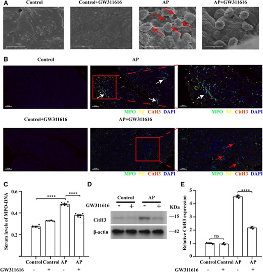 GW311616 reduces NET formation in AP. (A) Scanning electron microscopy showing extracellular web-like structures around the neutrophil infiltrate in AP mouse pancreatitis tissue (shown by red arrows). Scale bars: 10 μm. (B) Representative immunofluorescence images of NE, MPO, and CitH3 staining in the indicated groups. White arrows indicate NETs costained with NE, MPO, and DAPI; red arrows indicate intact neutrophils; and yellow arrows indicate CitH3. Nuclei were stained with DAPI (blue), whereas NE, MPO, and CitH3 were visualized in yellow, green, and red, respectively (scale bars = 100 μm). Images on the far right are magnified views (scale bar = 50 μm). (C) Serum levels of MPO–DNA in mice with AP (n = 6). (D and E) GW311616 inhibits the expression of CitH3 in the AP mouse model. CitH3 expression levels in the indicated groups were detected using western blotting (n = 3). Data are presented as the means ± sem, ****p < 0.0001; **p < 0.01; ns, not significant. AP, acute pancreatitis; CitH3, citrullinated histone 3, NET, neutrophil extracellular trap; NE, neutrophil elastase; MPO, myeloperoxidase; DAPI, 4′,6-diamidino-2-phenylindole