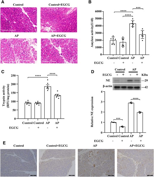 EGCG attenuates pancreatic tissue damage in SAP. (A) Representative H&E images of pancreatic tissue sections for the indicated groups. Scale bars: 200 μm. (B) Quantification of serum amylase levels (n = 6). (C) Quantification of trypsin activity levels (n = 6). (D) EGCG inhibits NE expression in the AP mouse model; NE expression in the indicated group was detected using western blotting (n = 3). (E) Representative immunohistochemistry images of NE-stained pancreatic tissue sections of the indicated groups. Scale bars: 100 μm. Data are presented as the means ± sem, ****p < 0.0001; ***p < 0.001. AP, acute pancreatitis; NE, neutrophil elastase; EGCG, epigallocatechin-3-gallate