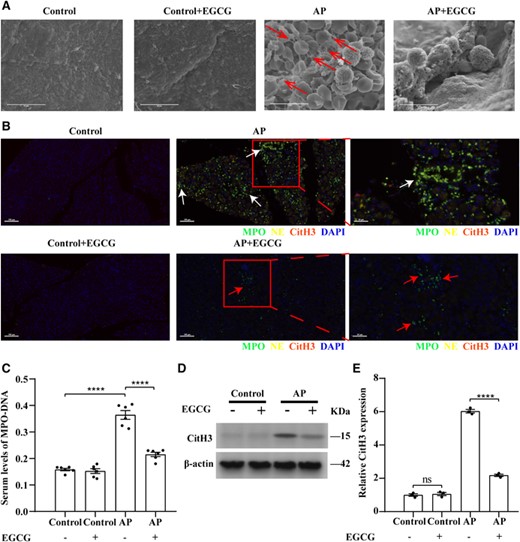 EGCG reduces NET formation in AP. (A) Scanning electron microscopy showing extracellular web-like structures around the neutrophil infiltrate in AP mouse pancreatitis tissues (red arrows). Scale bars: 10 μm. (B) Representative immunofluorescence images of staining for NE, MPO, and CitH3 in the indicated groups. White arrows indicate NETs costained with NE, MPO, and DAPI, and red arrows indicate intact neutrophils. Nuclei were stained with DAPI (blue), whereas NE, MPO, and CitH3 are shown in yellow, green, and red, respectively (scale bars = 100 μm). Images on the far right are magnified views of inserts (scale bar = 50 μm). (C) Serum levels of MPO–DNA in mice with AP (n = 6). (D and E) EGCG inhibits CitH3 expression in the AP mouse model; CitH3 expression in each group was detected using western blotting (n = 3). Data are presented as the means ± sem, ****p < 0.0001; **p < 0.01; ns, not significant. AP, acute pancreatitis; CitH3, citrullinated histone 3; EGCG, epigallocatechin-3-gallate; MPO, myeloperoxidase