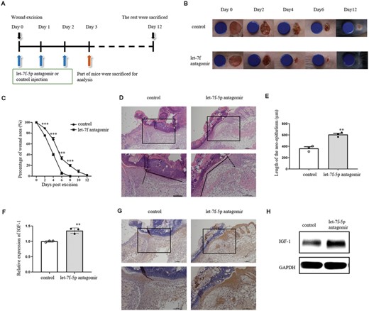 Let-7f-5p antagomir facilitated wound healing in IL-1β-treated mice. (A) Age- and sex-matched WT mice were treated with IL-1β (20 ng/wound) and let-7f-5p antagomir or control (5 nM/wound) on days 0, 1 and 2 after wounding. Skin biopsies at wound sites were obtained on day 3 postoperation for the following experiments (n = 5/group) (D–L). Wound healing on the rest mice was observed until day 12 after excision (n = 10/group). (B) Representative wound photographs on days 0, 2, 4, 6, and 12 postexcision. The blue discs indicate the initial wound size (diameter = 6 mm). (C) Wound closure rates were calculated on days 0, 2, 4, 6, 8, 10, and 12 postwounding. (D) Re-epithelialization of full-thickness skin wound margin was analyzed by H&E. (E) Length of the neoepithelium of skin wound margin were measured in groups treated with control or let-7f antagomir. (F–H) Expression of IGF-1 was analyzed by qRT-PCR (F), immunohistochemical detection (G), and WB (H). The data represent the mean ± sd of 3 independent experiments. p Values were calculated by one-way ANOVA with Bonferroni posttests (C) or two-tailed Student's unpaired t-test (E and F) (**p < 0.01, ***p < 0.001)