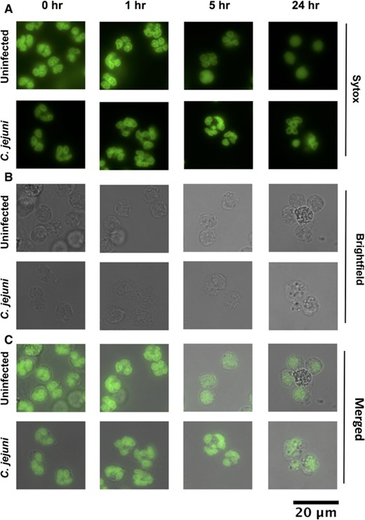 Morphology of neutrophil nuclei upon C. jejuni infection. (A) Green fluorescence, DNA stained with Sytox. (B) Brightfield. (C) Merge. Hypersegmentation is defined as > 4 nuclear lobes. Condensed, 1 lobed nuclei are indicative of apoptosis. 63×. Representative images, n = 3, separate donors, > 150 neutrophils scored per timepoint