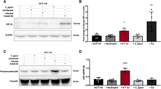 HIF-1α stabilization and p65 phosphorylation of NF-κB are increased in HCT-116 colonocytes coincubated with C. jejuni-infected neutrophils. (A) Western blot of HIF-1α and β-actin of HCT-116 colonocyte cell lysates alone or after 1-h coincubation with uninfected neutrophils, neutrophils infected with C. jejuni (MOI 1:1) for 5 h, C. jejuni alone, or cobalt (II) nitrate as a positive control. (B) Densitometry of HIF-1α relative to β-actin. (C) Western blot of phosphorylated p65 subunit of NF-κB relative to the total p65 subunit of NF-κB of HCT-116 colonocyte cell lysates alone or after 1-h coincubation with uninfected neutrophils, C. jejuni alone, neutrophils infected with C. jejuni (MOI 1:1) for 5 h, or cobalt (II) nitrate. (D) Densitometry of the phosphorylated p65 subunit of NF-κB relative to the total p65 subunit of NF-κB. Densitometry displayed as mean + sem. (A) Nonparametric test and (B) one-way ANOVA. *p < 0.05, **p < 0.01, ***p < 0.001, ****p < 0.0001 compared with uninfected. (A) Representative image, n = 3, separate donors, (B) n = 3, separate donors, (C) representative image, n = 3, separate donors, and (D) n = 3, separate donors