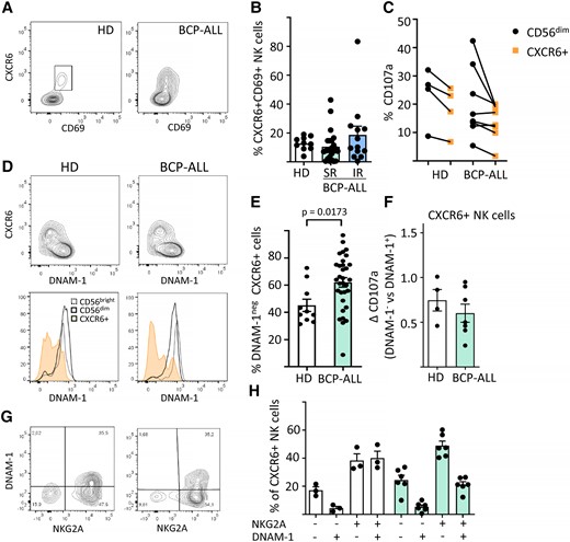Higher frequencies of CXCR6+DNAM-1negNKG2A+ BM NK cells in BCP-ALL patients. (A) Representative flow cytometry plots showing of CXCR6 + CD69+ BM NK cells in healthy donors (HDs) or BCP-ALL patients. (B) Frequencies of CXCR6+CD69+ BM NK cells in HDs (n = 10) or BCP-ALL patients at diagnosis according to their risk status: SR (n = 25), IR (n = 13). Data are presented as percentage ± SEM. (C) Degranulation of CD56dim or CXCR6+ BM NK cells after co-incubation of BM mononuclear cells with K562 target cells for 4 h. (D) DNAM-1 expression by BM NK cell subsets in HDs or BCP-ALL patients. (E) Frequencies of DNAM-1neg CXCR6+ NK cells in HDs (n = 10) vs BCP-ALL patients (n = 38). (F) Degranulation of DNAM-1posCXCR6+ vs DNAM-1negCXCR6+ BM NK cells in HDs (n = 4) vs BCP-ALL patients (n = 7). (G, H) Frequencies of DNAM-1/NKG2A subsets in HDs (n = 3) vs BCP-ALL patients (n = 6). Data presented as percentage ± SEM, statistical significance was calculated using the nonparametrical Mann-Whitney test.