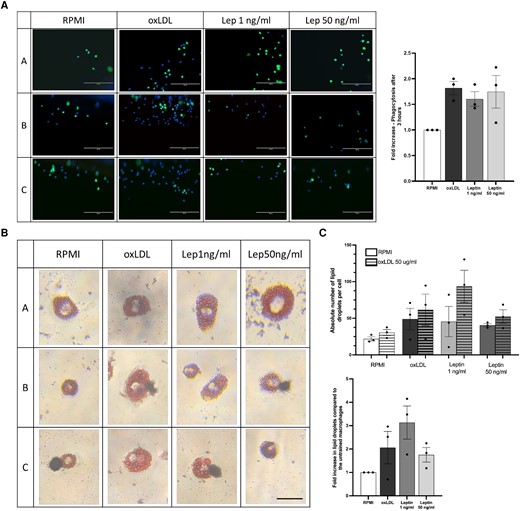 Training human primary monocytes with human recombinant leptin and oxLDL augments phagocytosis and foam cell formation. Human primary monocytes were exposed during 24 h to human recombinant leptin (1 and 50 ng/mL) or oxLDL 10 µg/mL. (A) After 6 d, the macrophages were exposed to fluorescent latex beads for 3 h and after washing images with the EVOS microscope were made to measure fluorescent beads uptake (10× magnification, scale bar = 200 μm). The uptake of beads in oxLDL and leptin-trained cells is expressed as fold change compared to the untrained control cells (n = 3). (B) Foam cell formation was induced by incubating the trained macrophages for 24 h with RPMI only or oxLDL 50 µg/mL followed by Oil Red O staining. (C) Foam cell morphology and lipid uptake quantification of trained macrophages was compared with untrained control (n = 3; scale bar = 25 μm).