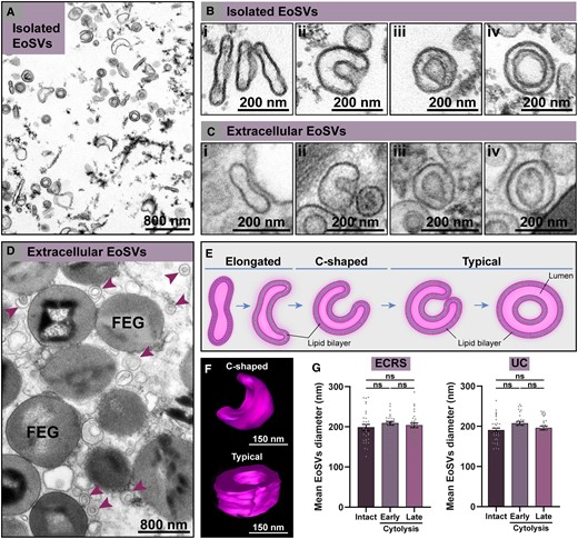Morphological characterization of cell-free sombrero vesicles (EoSVs). (A, B) A fraction of isolated EoSVs by subcellular fractionation from peripheral blood human eosinophils. (B) Higher magnification of isolated EoSVs showing the morphology and the trilaminar aspect of the vesicles membranes. (C, D) Extracellular tissue EoSVs showing intact membranes and the same morphologies as seen in (B). Both cytoplasmic and extracellular EoSVs appear as elongated (Bi, Ci), curved with varying curvatures, including C-shaped (Bii, Cii), and round (typical sombreros) showing (Biii, Ciii) or not (Biv, Civ) the contacted opposing tubular edges. These morphologies are illustrated in (E) and shown in 3 dimensions by electron tomography in (F). Reconstructions were done from an extracellular C-shaped EoSV present in inflamed tissue and a typical cytoplasmic EoSV. (G) Quantitative analysis revealed that the mean diameter of EoSVs with typical sombrero morphology did not change when comparing vesicles from intact cells and late and early cytolytic eosinophils in both ECRS and UC. A total of 180 EoSVs (90 for each condition) were randomly selected and analyzed. Samples from isolated EoSVs and biopsies from patients with ECRS (n = 2) and UC (n = 16) were prepared for TEM. Results are expressed as mean ± SEM (ns, not significant, P > 0.05). FEG, free extracellular granule. See also Supplementary Movie 1 (Supplementary material).