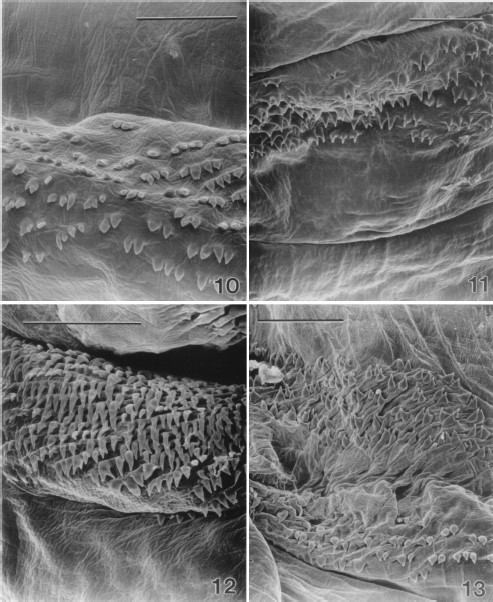 Scanning electron micrograph of spines on the dorsal surface of a thoracic segment of a second-instar sarcophagid removed from between an infant's toes. (10) Caudally oriented spines are sparse and taper broadly to a fine point. Most have a single point although occasional spines will have multiple points (Bar=50μm). (11) Spines on the ventral surface of a thoracic segment of a second-instar sarcophagid. Spines are arranged in bands at the anterior edge of each segment and are more dense than on the dorsal surface. Caudally oriented spines taper rapidly to a fine point. Most have a single point although occasional spines will have multiple points. (Bar=50μm). (12) Spines on the dorsal surface of an abdominal segment of a second-instar sarcophagid. Caudally oriented spines are more robust and longer than those on the anterior segments and are arranged in dense bands at the anterior edge of each segment. They taper rapidly to a fine point although occasional spines will have double points. (Bar=50μm). (13) Spines on the ventral surface of the seventh abdominal segment of a second-instar sarcophagid. Spines in the lower portion of the image are oriented cephalad and are located at the posterior edge of the segment. Spines in the upper portion of the image are oriented caudally and are on the anterior portion of the segment. (Bar= 50 μm).