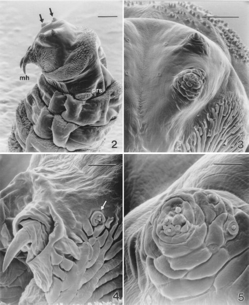 Low magnification scanning electron micrograph of the cephalic segment and the thoracic segments of a second-instar sarcophagid removed from between an infant's toes. (2) Cephalic sensilla (arrows), mouth hooks (mh), prothoracic spiracles (prs), and distribution of spines on these segments are evident (Bar = 100 μm). (3) Antennal (upper) and maxillary (lower) sensory complexes (Bar=50μm). (4) Detail of a mouth hook and the oral ridges. Mandibular sensory complex is evident (arrow) (Bar = 25 μm). (5) Maxillary sensory complex of a second-instar sarcophagid (Bar = 10 μm).