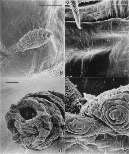 Scanning electron micrograph of the prothoracic spiracles of a second-instar sarcophagid removed from between an infant's toes. (6) Six spiracular openings (Bar = 50 μm). (7) Three cuticular sensilla on the ventral surface of a thoracic segment of a second-instar sarcophagid. From left to right, a trichoid sensillum with three setae, a campaniform, and a coeloconic sensillum are present (Bar = 25 μm). (8) Low magnification scanning electron micrograph of the terminal abdominal segments of a second-instar sarcophagid. Spiracular plates can be seen within the stigmal cavity, anal papillae are evident as are papillae with sensillae surrounding the stigmal cavity (Bar = 100 μm). (9) Terminal abdominal segment of a second-instar sarcophagid (Bar = 10 μm).