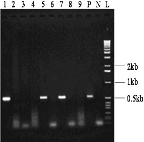 One percent agarose gel illustrating the 546 bp product characteristic of the HGE agent after nested PCR amplification. Lanes 1–9: tick samples. Tick samples in lanes 1, 5, and 7 are positive, all from Jekyll Island, GA (voucher numbers 324, 325, and 328).Lane P: positive control. Lane N: negative control. Lane L: 1 kb standard marker.