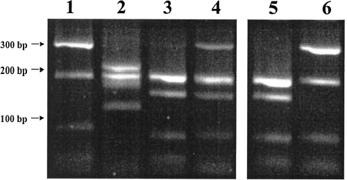 PCR amplified ITS1 region from mosquitoes in the Culex sitiens subgroup digested with RsaI and run in a 3.0% agarose gel. Lane 1, Cx. annulirostris (Brisbane); lane 2, Cx. sitiens (Brisbane), lanes 3 and 4 are the two RFLP profiles shown by Cx. palpalis (Jabiru). Lanes 5 and 6 are the two separate ITS1RFLP profiles derived from clones of the Cx. palpalis genotype in lane 4.