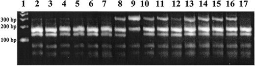 ITS1 PCR-RFLP analysis of Culex sitiens subgroup mosquitoes collected from Balimo, PNG, in 1997. Most of the mosquitoes were identified as Cx. palpalis with one Cx. annulirostris (lane 9). Allozyme analysis of material from the same collection pool showed 94.9% Cx. palpalis (see Table 3 for allozyme comparisons). A 300 bp band can be observed in a subpopulation of Cx. palpalis individuals.