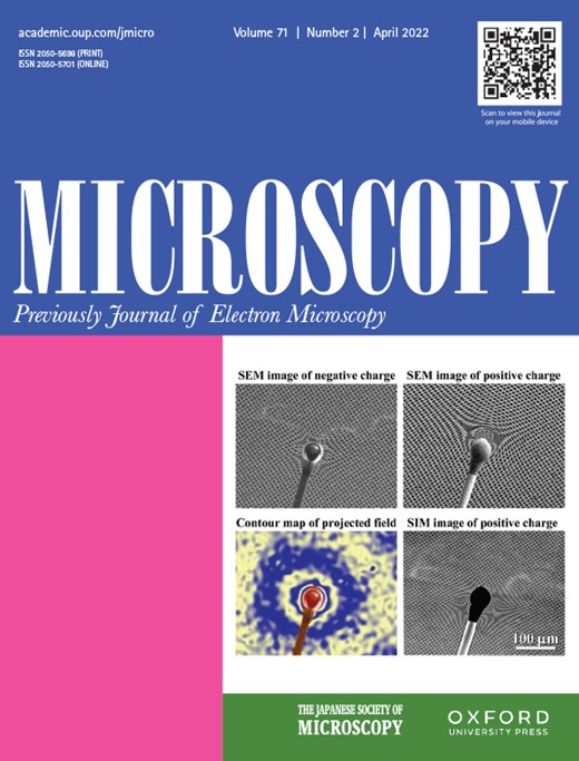Microscopy Cover Image for Volume 71, Issue 2