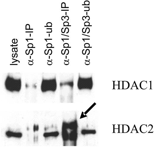 Sp1 and Sp3 are associated with HDAC1 and HDAC2. MCF-7 (T5) cell lysate, IP and ID fractions were prepared as described for Fig. 7 and were loaded onto an SDS 10% polyacrylamide gel, transferred to nitrocellulose membranes and immunochemically stained with anti-HDAC1 and -HDAC2 antibodies. Arrow indicates the HDAC2 species with reduced mobility ( 7). (J. Biol. Chem. 277: 35783–35786, with permission.)