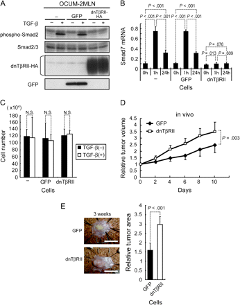 Disruption of TGF-β in gastric cancer cells and tumors. We used parental OCUM-2MLN cells, 2MLN cells expressing GFP (termed 2MLN-GFP cells) as a control, and 2MLN cells expressing a dnTβRII (termed 2MLN-dnTβRII cells). A) TGF-β signal transduction in the cells. Immunoblot analysis was used to compare the level of phosphorylated Smad2 (phospho-Smad2) with that of Smad2 and 3 as control, in parental OCUM-2MLN cells (lanes – = cells carry no constructs), 2MLN-GFP cells (lanes GFP), and 2MLN-dnTβRII cells (lanes dnTβRII), treated with TGF-β3 (1 ng/mL) or left untreated for 1 hour. Expression of dnTβRII protein (by use of hemagglutinin [HA] tag), and that of GFP, as a control for lentiviral infection was also determined by immunoblot analysis. The cells were subjected to immunoblot analysis with antibodies against the proteins indicated to the left. The experiment was conducted two times, and data from one representative experiment are shown. B) Human Smad7 mRNA expression. Quantitative real-time polymerase chain reaction was used to assess the level of expression of human Smad7 mRNA in all three cell lines after treatment with TGF-β3 (1 ng/mL), as indicated. The experiment was conducted two times, each sample was assessed in triplicate, and data were averaged. Data from one representative experiment are shown. C) Proliferation of gastric cancer cells in the presence of TGF-β3. Cells were treated with TGF-β3 (1 ng/mL) in 10% fetal bovine serum for 3 days; control cells were not treated with TGF-β3. The experiment was conducted two times, each sample was assessed in triplicate, and data were averaged. Data from one representative experiment are shown. D) Growth of 2MLN-GFP and 2MLN-dnTβRII tumors in nude mice for 10 days. Cells were subcutaneously transplanted into nude mice (n = 8 mice per group). E) Growth of orthotopic 2MLN-GFP and 2MLN-dnTβRII tumors in nude mice. Cells were transplanted into the gastric wall of nude mice (n = 8 mice per group). Left) Macroscopic appearance of representative samples of excised gastric wall with an orthotopic tumor. Right) Relative areas of the 2MLN-GFP and 2MLN-dnTβRII tumors. Scale bar = 10 mm. Error bars = 95% confidence intervals. All P values (two-sided) were calculated by using a Student's t test, except for that in (D), which was calculated by using a two-way repeated measures analysis of variance. dnTβRII = dominant-negative TGF-β type II receptor; GFP = green fluorescent protein; TGF-β = transforming growth factor β.