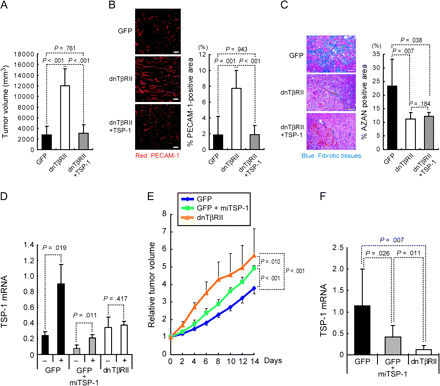 Expression of TSP-1 and tumor growth in nude mice. A) Tumor volume and TSP-1 expression. The 2MLN-dnTβRII cells, which stably express TSP-1, are termed 2MLN-dnTβRII+TSP-1. Volumes of the subcutaneous tumors produced by 2MLN-GFP, 2MLN-dnTβRII, and 2MLN-dnTβRII+TSP-1 cells were determined 7 days after inoculation (n = 6 mice per group). B) Vascular density at 7 days after inoculation as determined by immunostaining for PECAM-1. Left) Immunostaining with antibody against PECAM-1. Scale bars = 100 μm. Right) Percent PECAM-1–positive area (n = 3 with each condition). C) Fibrotic tissue as determined by AZAN staining in the subcutaneous tumors 7 days after inoculation. Left) Micrographs with fibrotic tissue stained blue by AZAN staining. Scale bars = 100 μm. Right) Percent AZAN-positive area (n = 3 with each condition). D) The effect of miTSP-1 mRNA expression in the gastric cancer cells as determined by TSP-1 mRNA expression. The 2MLN-GFP, 2MLN-GFP+miTSP-1, and 2MLN-dnTβRII cells were treated with TGF-β or left untreated for 24 hours in vitro, and expression of TSP-1 mRNA was compared among the cell lines. The experiment was conducted two times, each sample was assayed in triplicate, and data were averaged. Data from one representative experiment are shown. E) Growth curves of 2MLN-GFP, 2MLN-GFP+miTSP-1, and 2MLN-dnTβRII xenograft tumors in nude mice (n = 6 in each condition). In 2MLN-GFP+miTSP-1 cells, the expression of TSP-1 was reduced by use of the miTSP-1. Tumor volume is shown relative to the average volume in each condition at day 0 after starting evaluation. F) Expression of TSP-1 mRNA in the 2MLN-GFP, 2MLN-GFP+miTSP-1, and 2MLN-dnTβRII tumors in vivo. Experiment was conducted two times, each sample was assessed in triplicate, and data were averaged. Data from one representative experiment are shown. Error bars = 95% confidence intervals. All P values (two-sided), except for those in (E), were calculated using the Student's t test. P values in (E) were calculated by two-way repeated measures analysis of variance. dnTβRII = dominant-negative TGF-β type II receptor; miTSP-1 = microRNA against thrombospondin-1; GFP = green fluorescent protein; TGF-β = transforming growth factor β; TSP-1 = thrombospondin-1; PECAM-1 = platelet–endothelial cell adhesion molecule-1.